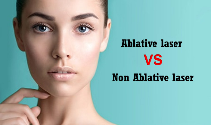 Was ist der Unterschied zum ablativen und nicht ablativen Laser?