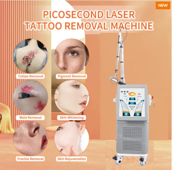 Picosencond-Laser --- Wie entfernt man Tätowierungen effektiv?