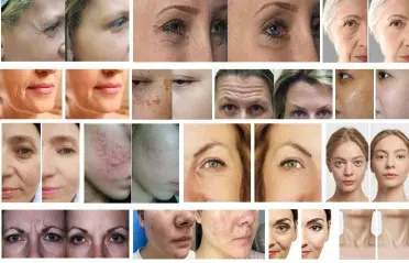 15 In 1 Skin Care Hydro Facial Machine