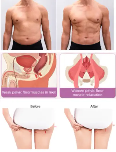 Ems Muscle Stimulation Rf Body Shaping Beauty Machine